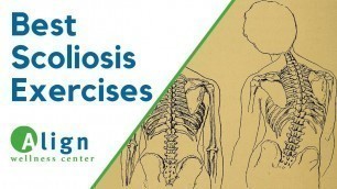 'Scoliosis Exercises For Children Ages 10-18'