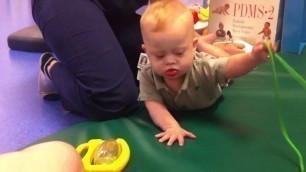 'Down syndrome physical therapy exercises for children born with Down syndrome'