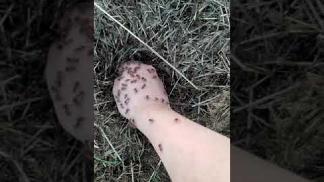 I stuck my hand in an ant hill... OUCH