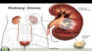 'Food For Kidney Disease - Know Which Foods Boost Kidney Function And Which Ones Harm'