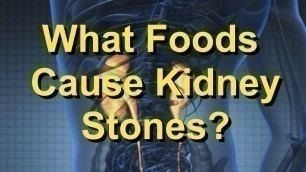 'What Foods Cause Kidney Stones?'