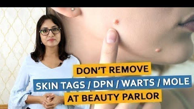 'Don\'t Remove SKIN TAGS / DPN / WARTS / MOLE At Beauty Parlor | Dr. Deepika Lunawat'