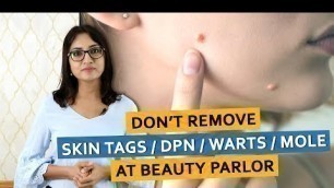 'Don\'t Remove SKIN TAGS / DPN / WARTS / MOLE At Beauty Parlor | Dr. Deepika Lunawat'