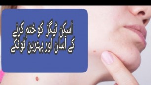 'how to easily remove skin tags|moles blackheads || Eman Beauty Tips'