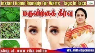 'Beauty Tips / Remedy For Warts - Tags /மருவிற்குத் தீர்வு / அனிதா குப்புசாமி / Anitha Kuppusamy'